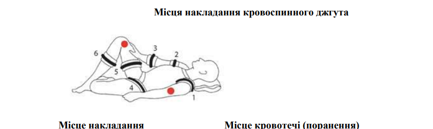 Як правильно накласти джгут