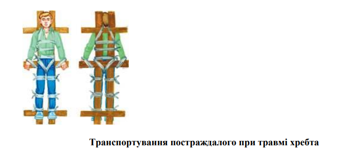 Як транспортувати людину з травмою хребта